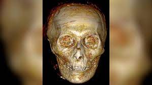 Researchers used CT scans to virtually unwrap a pristine mummy